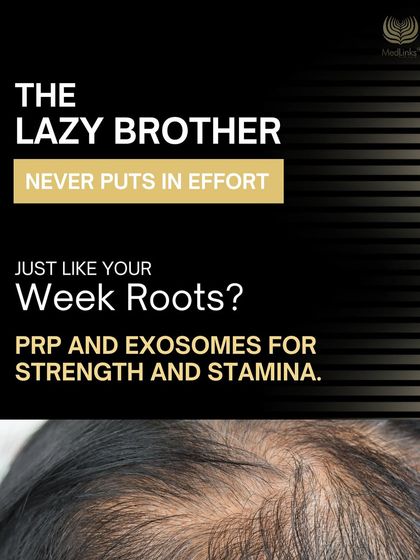 Are your hair roots weak and lazy, just like that brother who never puts in effort? PRP and Exosomes can provide the strength and stamina your hair needs.