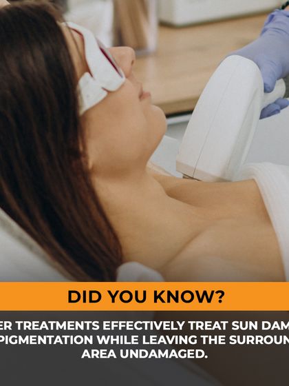 Did you know that laser treatments can effectively target sun damage and pigmentation? The technology allows us to precisely treat the affected cells while leaving the surrounding tissue undamaged, ensuring a safe and targeted procedure.