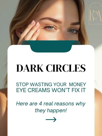 Are you tired of eye creams that don't deliver? The truth is, most dark circles are caused by deeper issues like genetics, pigmentation, or volume loss, not just lack of sleep. It's time to stop treating the symptom and address the real cause.