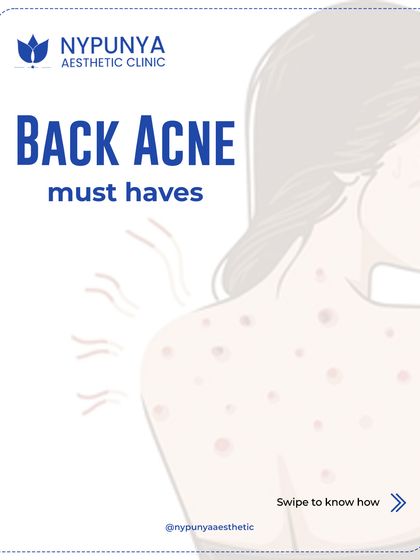 Back acne is a common concern, especially with humidity and sweat. These breakouts are not just "heat bumps" and require a targeted approach to treat effectively.