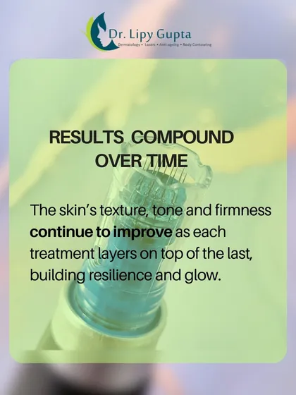 The results of microneedling compound over time. With each treatment, your skin's texture, tone, and firmness continue to improve, building resilience and glow.