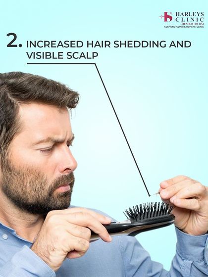 Increased hair shedding on your brush or in the shower, leading to a more visible scalp, is a clear indicator that it's time to seek a professional consultation.