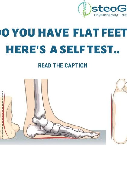 Do you have flat feet? This infographic explains a simple self-test you can do at home with water to check your footprint. It also shows the anatomical difference in a flat foot.