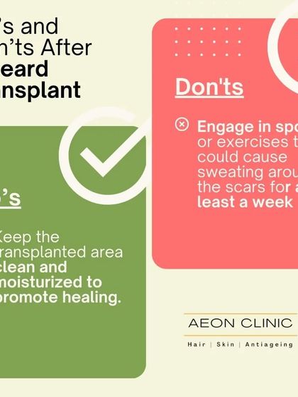 To promote healing after a beard transplant, keep the area clean and moisturized. Avoid sports or exercises that cause sweating around the area for at least a week.