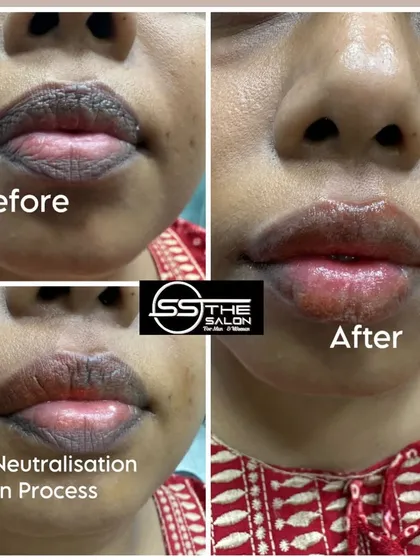 Here you can see the transformative power of my Lip Neutralisation service. This before and after collage shows how I correct dark pigmentation in just one session, resulting in lighter, more evenly toned lips, creating a perfect base for any lip color or a natural look.