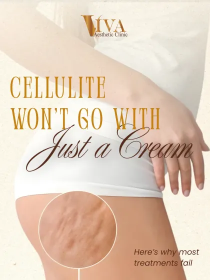 Many people believe cellulite will go away with just a cream, but it's a structural issue. This series explains why most home treatments fail and how professional assessment is key.