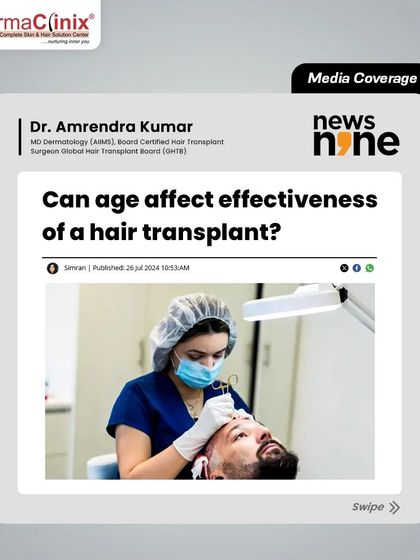 In this News9Live feature, Dr. Amrendra Kumar discusses how age can influence the effectiveness of a hair transplant, explaining why stable hair loss patterns in older patients often lead to more consistent results.