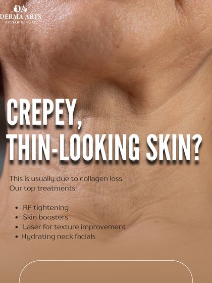 Crepey, thin-looking skin on the neck is usually due to collagen loss. This graphic outlines our top treatments like RF tightening, skin boosters, and laser.
