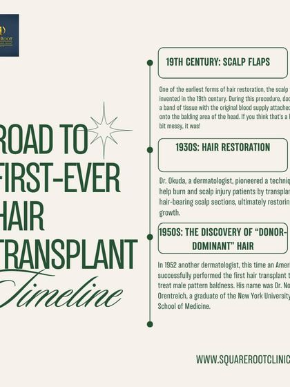 This timeline traces the fascinating history of hair transplants, from early scalp flap procedures in the 19th century to the pioneering techniques of the 1930s and 1950s that laid the foundation for modern hair restoration.