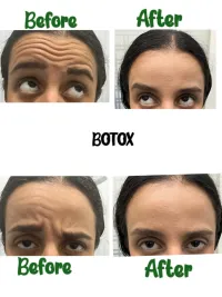 Injectables & Facial Contouring