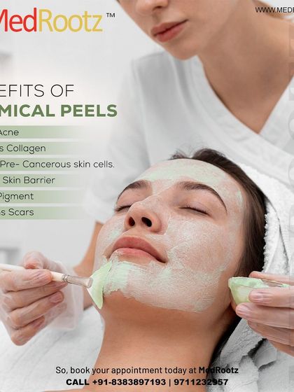 The benefits of a chemical peel are extensive. It can treat acne, help rebuild collagen, repair the skin's natural barrier, fade pigment, and smooth scars, making it a powerful restorative treatment.