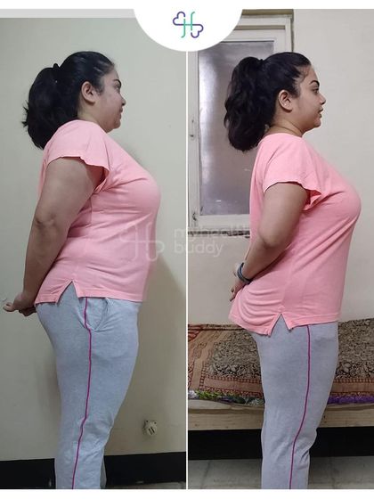 Losing 9 kgs in 12 weeks while managing PCOD and Thyroid. This client discovered that sustainable diets and constant support make the journey amazing.