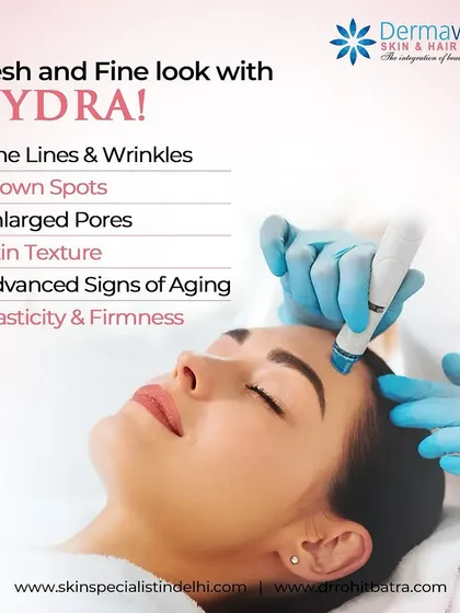 Here you can see the Hydrafacial treatment in action. It is a multi-step procedure that I use to provide deep cleansing, exfoliation, and intense hydration. It is an excellent option for tackling issues like enlarged pores, uneven texture, and dullness with no downtime.