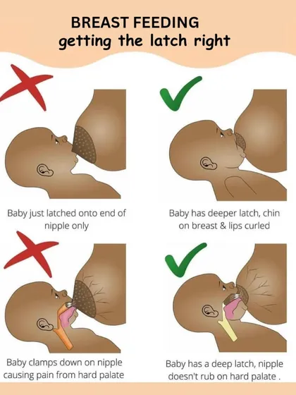 A proper latch is key to successful breastfeeding for both mother and baby. This clear visual guide shows the difference between a shallow, painful latch and a deep, effective one, ensuring your baby gets enough milk and you remain comfortable.