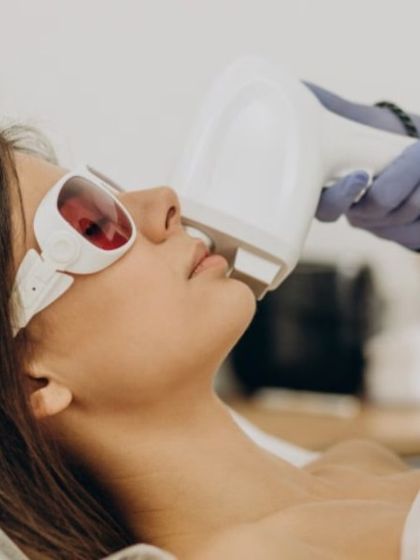 This patient is undergoing laser hair removal on her face. I ensure every session is comfortable by using protective eyewear and advanced cooling technology. This treatment effectively reduces hair growth, leading to clearer and smoother skin.