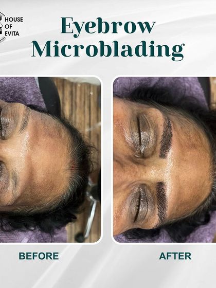 For this client, Microblading was used to create brows from very little natural hair, resulting in a complete and realistic-looking transformation.