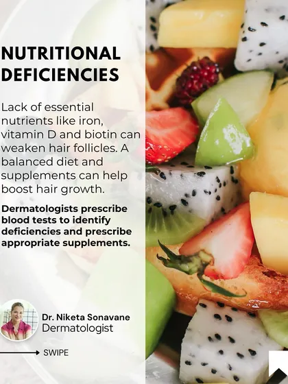 Nutritional deficiencies are a common cause of hair fall. A lack of essential nutrients like iron, vitamin D, and biotin can weaken hair follicles. I often prescribe blood tests to identify these deficiencies and recommend appropriate supplements.