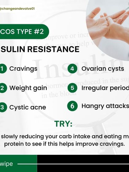 Insulin-resistant PCOS is characterized by cravings, weight gain, and irregular periods. To manage this, I recommend slowly reducing carbohydrate intake and increasing protein to help improve cravings and stabilize blood sugar.
