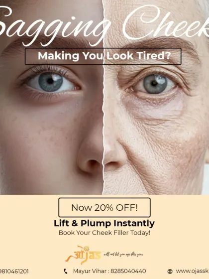 Sagging cheeks can make you look tired and drawn. With strategically placed cheek fillers, we can instantly lift and add volume to the mid face, restoring youthful contours and a plumper, healthier appearance.