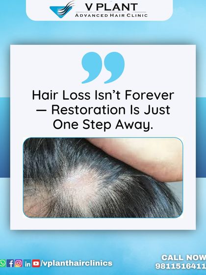 Seeing thinning patches can be discouraging, but hair loss isn't forever. Restoration is just one step away. We specialize in safe, effective treatments like MHI Transplant and PRP Therapy to stimulate natural regrowth and restore a healthy scalp, with natural-looking results.