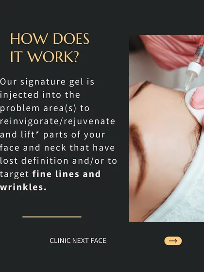 How does our Organic Lift work? A signature gel from your own blood is injected into problem areas to rejuvenate and lift parts of your face and neck that have lost definition.