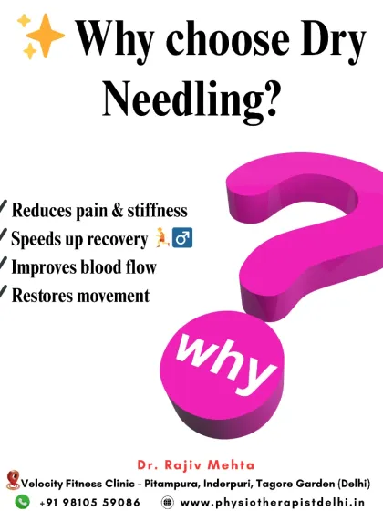 Why choose Dry Needling? This therapy is effective because it reduces pain and stiffness, speeds up recovery, improves blood flow to the affected area, and helps restore your natural movement patterns.
