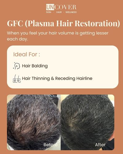 Hair & Scalp Treatments