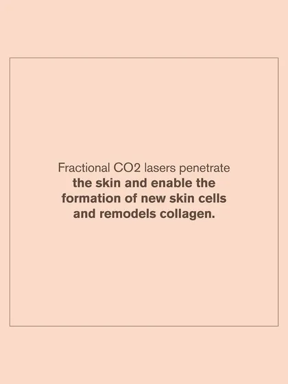 Fractional CO2 lasers work by penetrating the skin to enable the formation of new skin cells and remodel collagen. This is a key mechanism for treating deep acne scars.