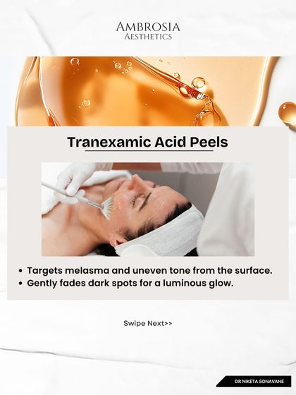 Tranexamic Acid Peels are excellent for surface-level concerns like melasma and uneven tone. This gentle peel effectively fades dark spots to reveal a luminous glow.