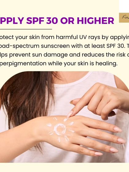 Sun protection is non-negotiable after a chemical peel. Apply a broad-spectrum sunscreen with at least SPF 30 to protect your healing skin from UV damage and prevent hyperpigmentation.