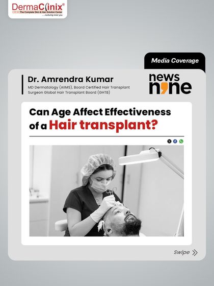 This News9Live article features Dr. Amrendra Kumar discussing how age can affect the effectiveness of a hair transplant. We believe in educating our patients so they can make the best decision.