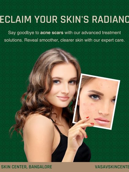 Sree Vasavi - Acne & Scar Treatment Patient Transformations photo 5