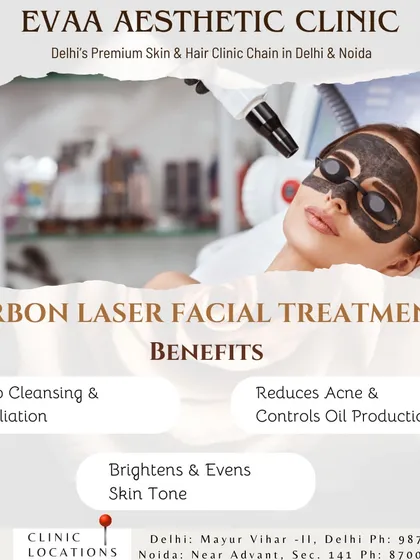 This graphic highlights the primary benefits of our Carbon Laser Facial treatments, such as deep cleansing, exfoliation, acne control, and brightening the skin tone.