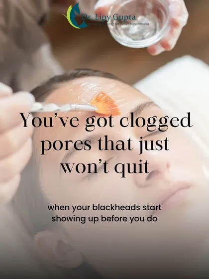 For clogged pores and blackheads that just won't quit, a professional facial or peel can provide the deep cleaning and exfoliation needed to clear them out effectively.