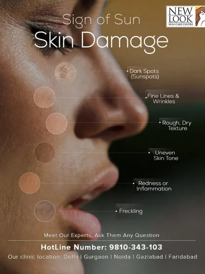 Understanding the signs of sun damage is the first step toward prevention and treatment. This graphic illustrates common issues like dark spots, fine lines, and uneven tone that we can address with our expert dermatological care.