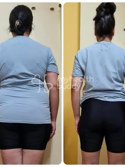 A look at Shipra's progress from the back. Notice the improved posture and reduction in waist circumference, results of consistent strength training and a balanced diet.