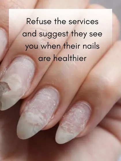 In some severe cases, the most responsible action is C: Refuse the service and suggest they return once their nails are healthier. Your long-term nail health is my priority.