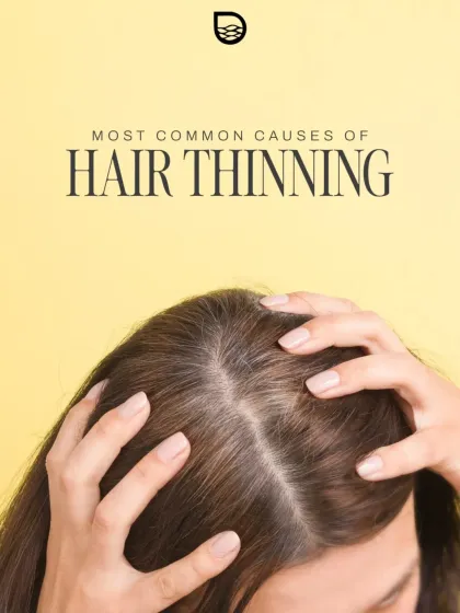 Hair thinning is a complex issue with multiple potential causes. My process always begins with a thorough assessment to understand the specific factors affecting you, ensuring that the subsequent treatment is correctly targeted for the best results.