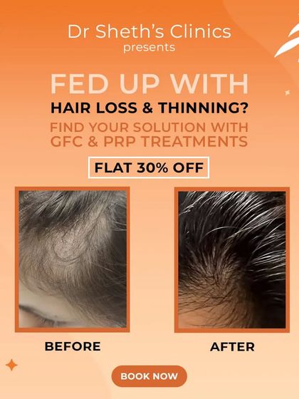We are dedicated to finding the right solution for your hair loss and thinning. This patient's result, achieved with our GFC and PRP treatments, shows a visible improvement in hair fullness and health.
