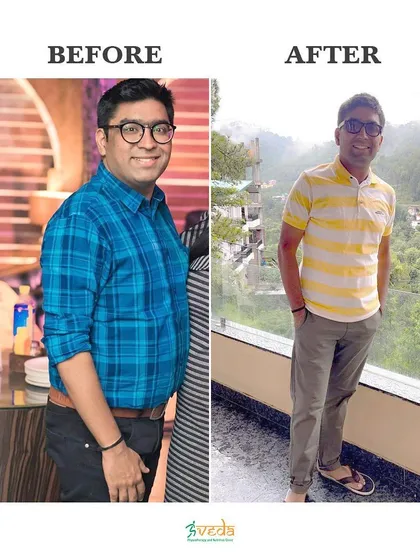 This client came to me to manage his diabetes and lose weight. In just three months, his fasting sugar level dropped from 149 to 89, and he lost 9kgs, proving that the right diet can dramatically improve health markers.