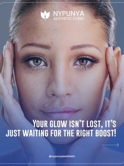 Your glow isn't lost, it's just waiting for the right boost. If your skin looks dull despite your skincare routine, it might be time for a professional treatment.