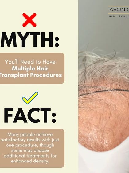 Myth: You'll need multiple hair transplant procedures. Fact: Many people achieve satisfactory results with just one procedure. Additional treatments are optional for enhanced density.