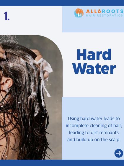 Using hard water for washing can lead to incomplete cleaning of your hair. This causes mineral and dirt remnants to build up on the scalp, which can clog follicles.