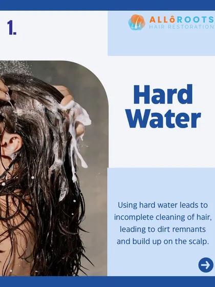 Using hard water for washing can lead to incomplete cleaning of your hair. This causes mineral and dirt remnants to build up on the scalp, which can clog follicles.