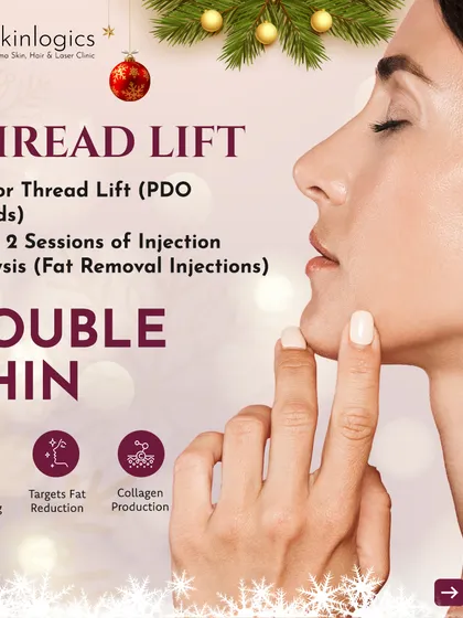 Target a double chin with this New Year offer. When you book a PDO Thread Lift for skin tightening, you get two complimentary sessions of Injection Lipolysis to reduce fat in the area.
