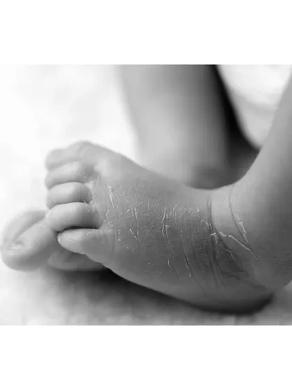 A black and white close-up of newborn feet. This perspective highlights the unique textures and wrinkles that are so characteristic of the first few weeks of life.