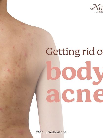 Urmila Nischal - Medical Dermatology Acne & Scarring Solutions photo 18