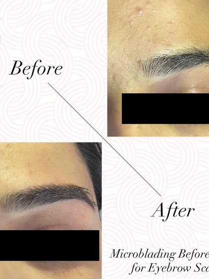 A before and after of microblading used to cover an eyebrow scar and create fuller, more defined brows.