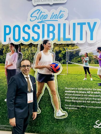 At a conference, I was happy to see new treatment options like Baricitinib becoming available for patients with atopic dermatitis. I was part of the global trials for this drug and saw firsthand how it helped patients get their condition under control.