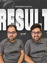 Non-Surgical Hair Replacement